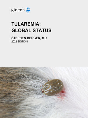 cover image of Tularemia
